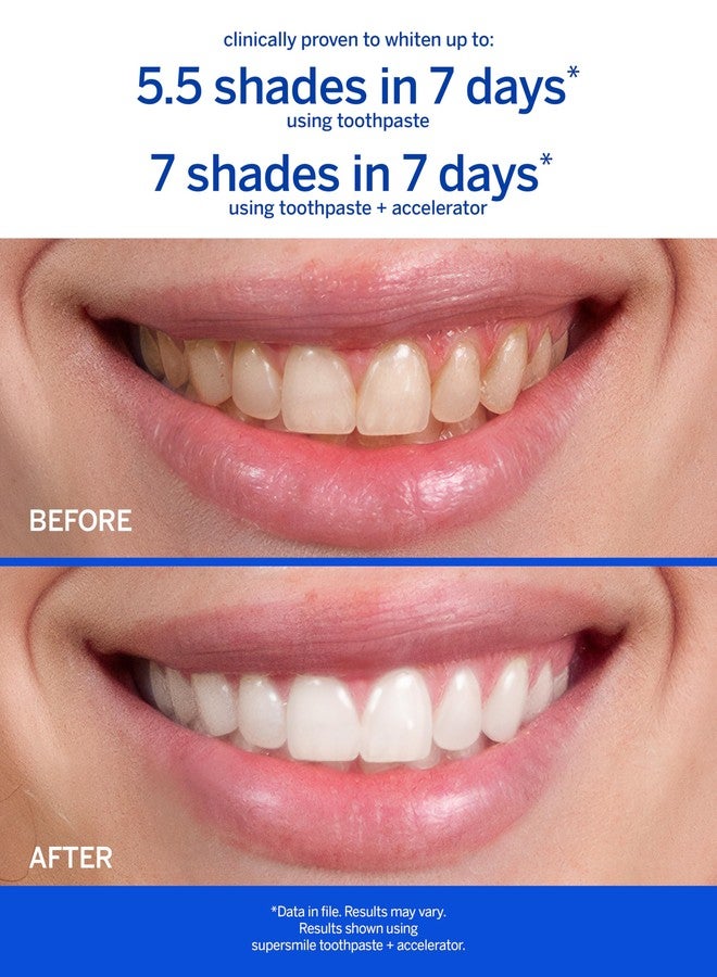 سوبر سمايل معجون أسنان سوبر سمايل برائحة ماء الورد والنعناع لتبييض الأسنان مع الفلورايد - تركيبة احترافية لأسنان أكثر بياضًا - يبيض حتى 6 درجات، 8 أونصة - Image 3